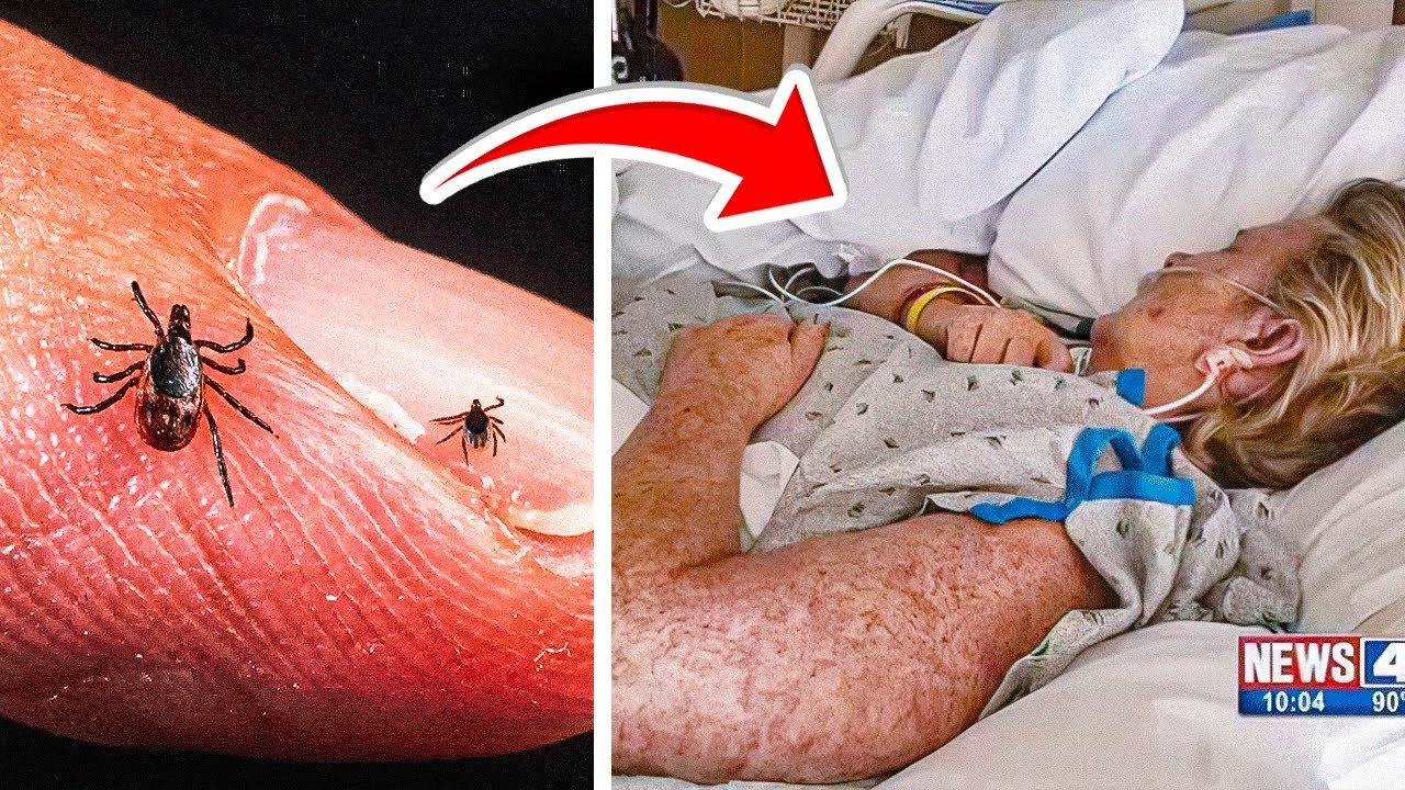 Mom Passes Away After Brushing Off ‘Normal’ Bug Bites